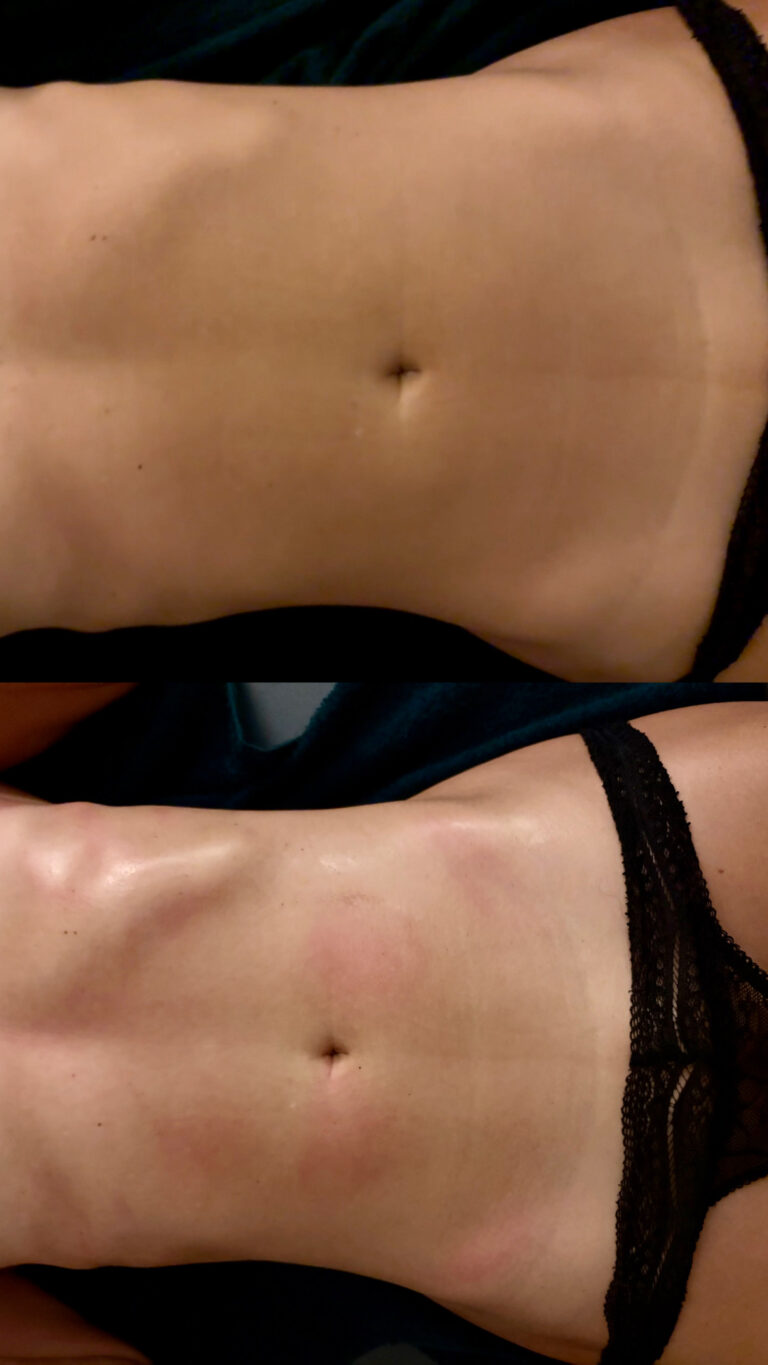 Antes e depois · Nathália Meyohas | Massoterapeuta Ayurvédica — massoterapia em Leblon - RJ, Rio de Janeiro - RJ